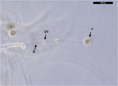 Coexistence of Two Invasive Species, Procambarus clarkii and Aphanomyces astaci, in Brackish Waters of a Mediterranean Coastal Lagoon